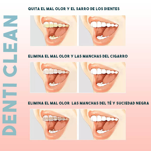 Denti Clean™ Cepillo removedor de sarro - Raspador ultrasónico