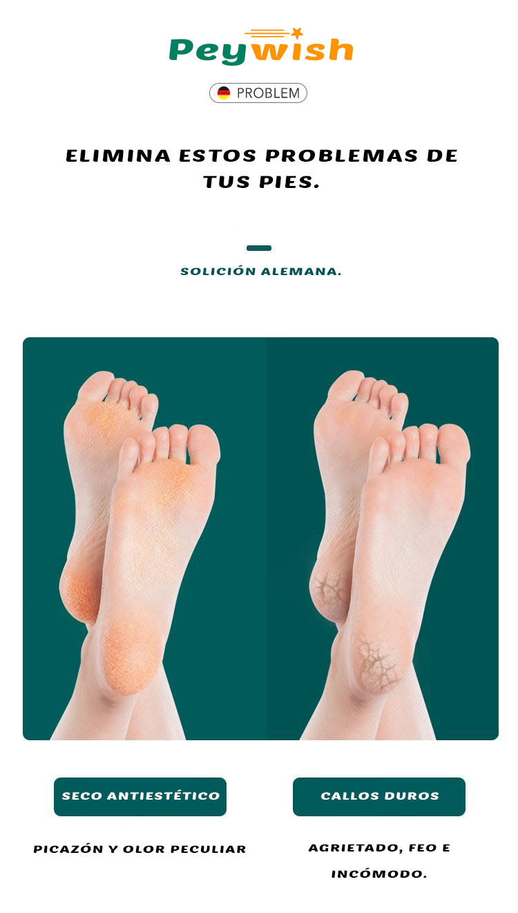 Foot Care™ Lima para pies